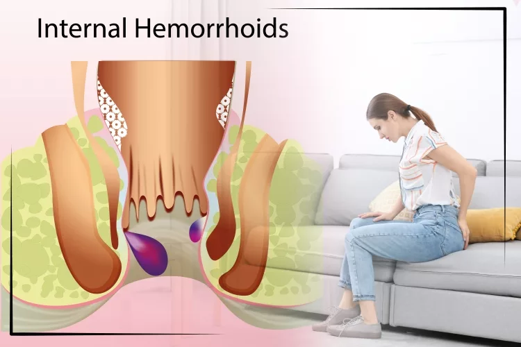 Young woman suffering from hemorrhoid pain on sofa at home