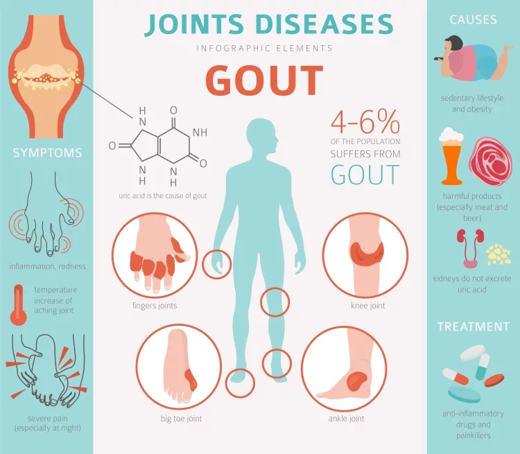 Gout Infographic : Causes and Symptoms