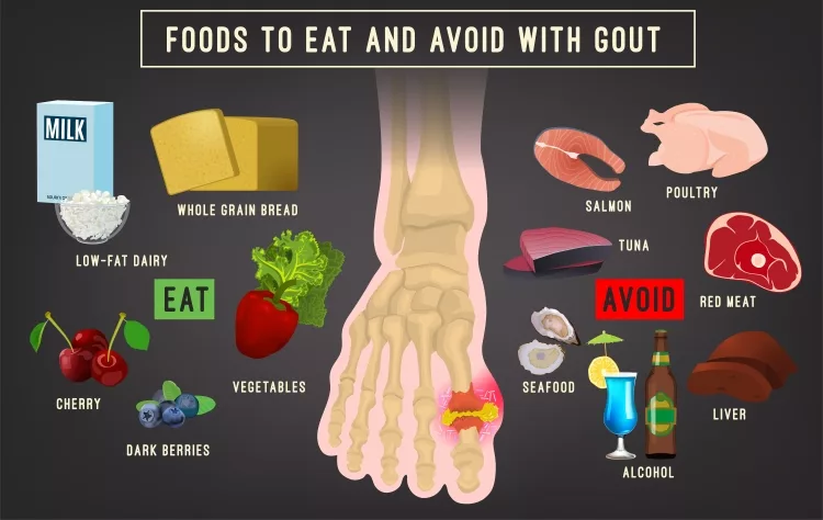 Types of Gout: