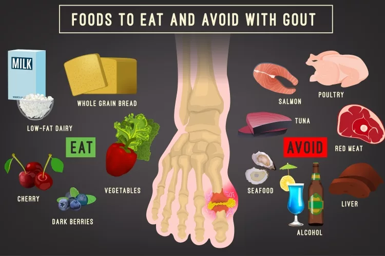 Food to Eat and Aboid With Gout arthritis infographic