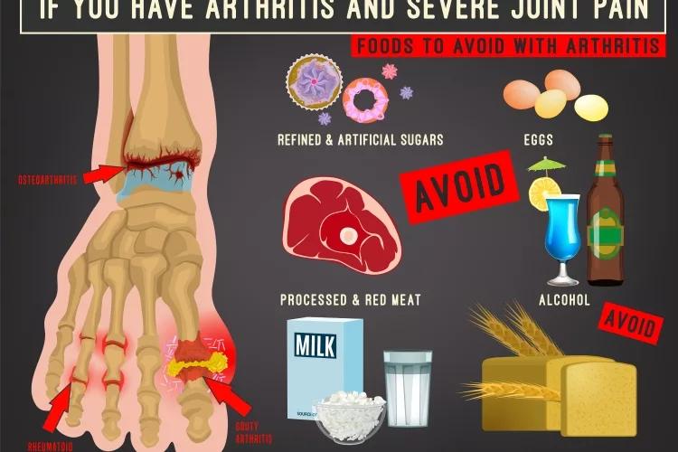 Arthritis foods image