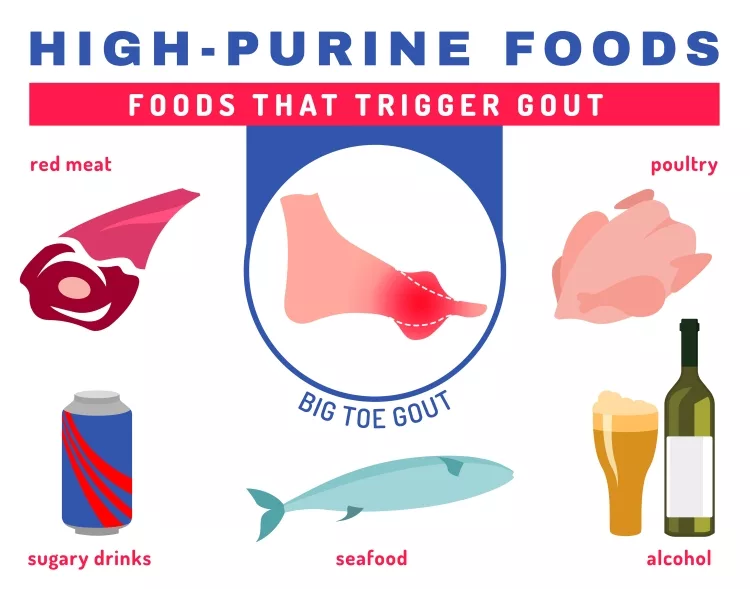 Foods that Trigger Gout
