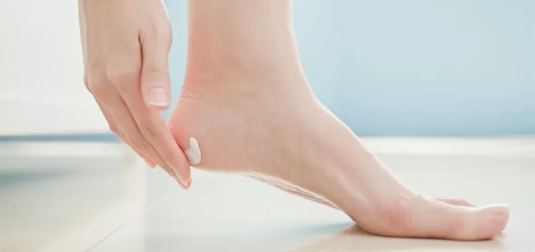 How to Sooth Dry and Cracked Heels Naturally
