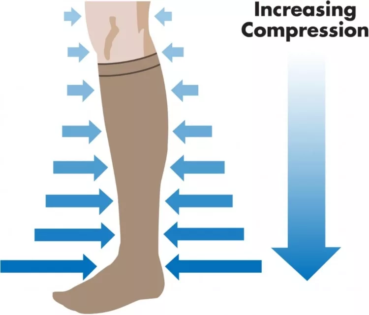Compression Socks for Swelling - A Great Solution to Consider