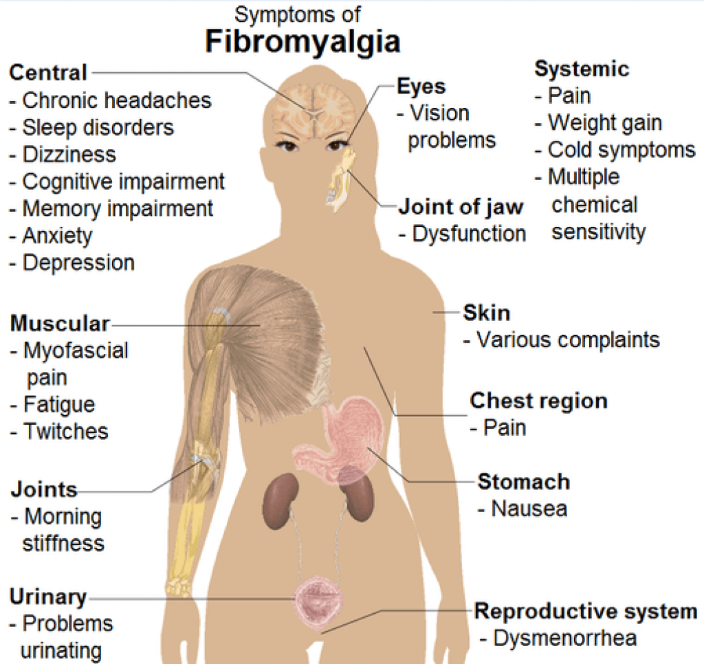 What happens if fibromyalgia is left untreated?