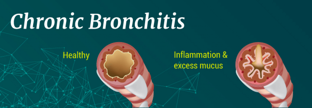 Chronic Bronchitis 