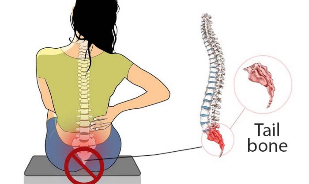 Why Do You Feel Tailbone Pain When Sitting Down And Getting Up