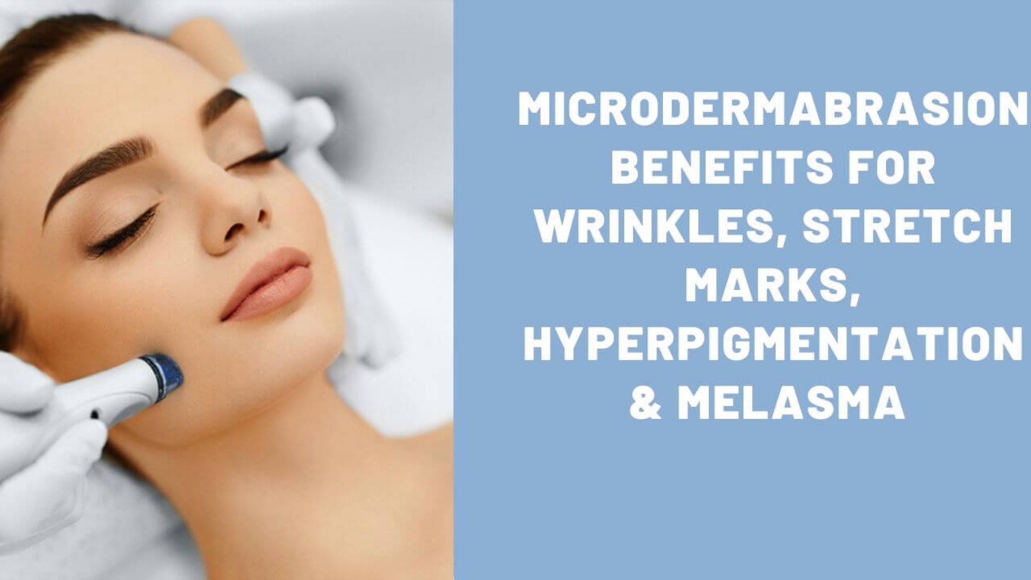 8 Microdermabrasion Benefits for Wrinkles, Hyperpigmentation & Melasma