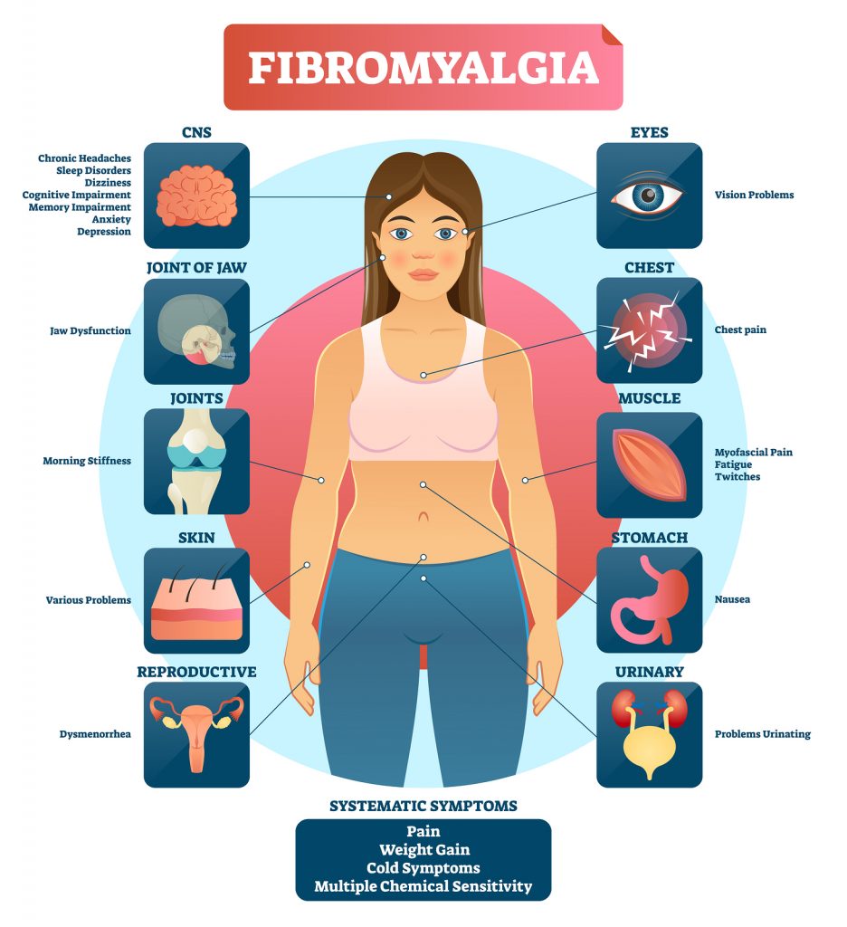 What happens if fibromyalgia is left untreated?