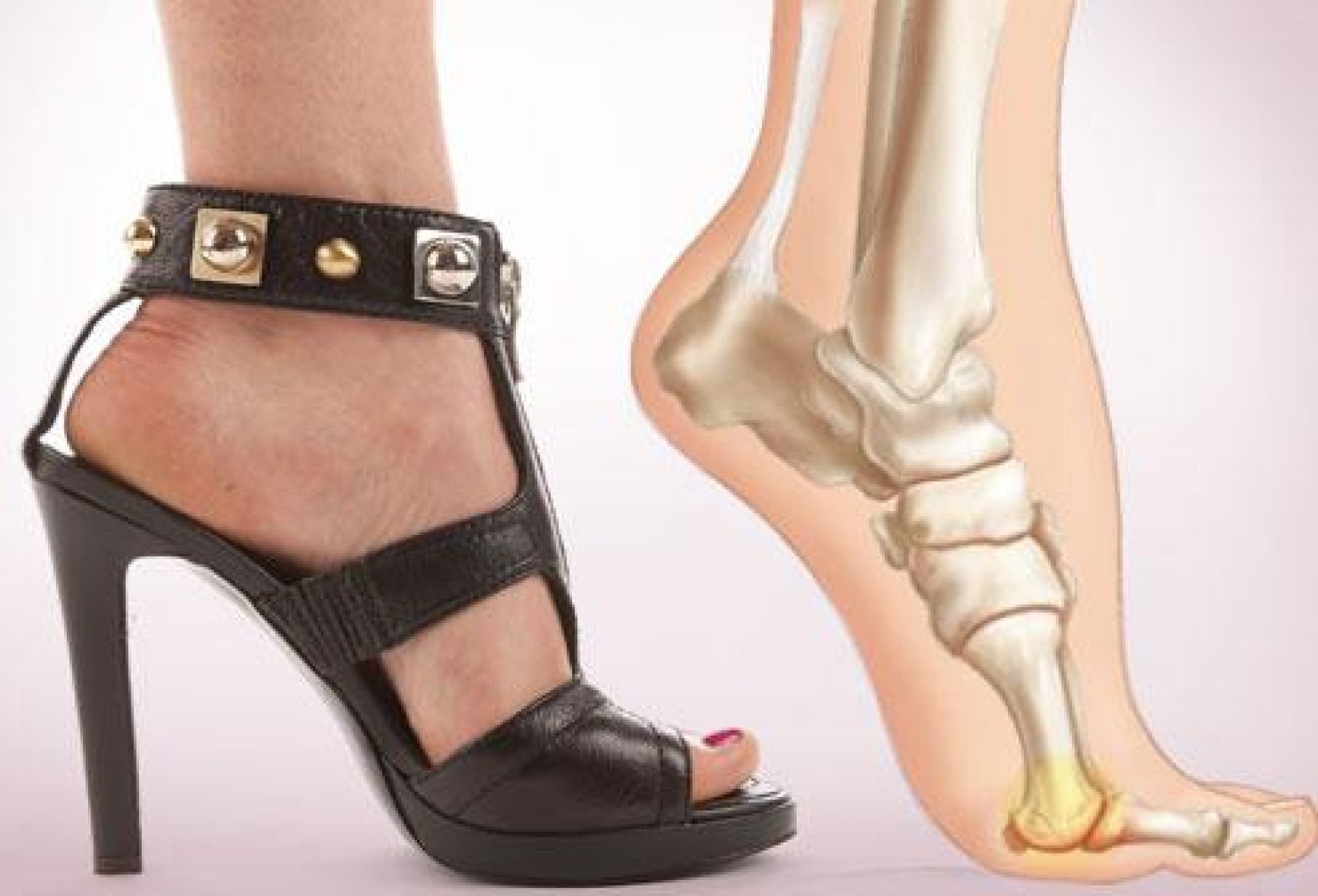 12 Best Shoes for Back Pain Expert Guide to the Best Shoes for Bad back